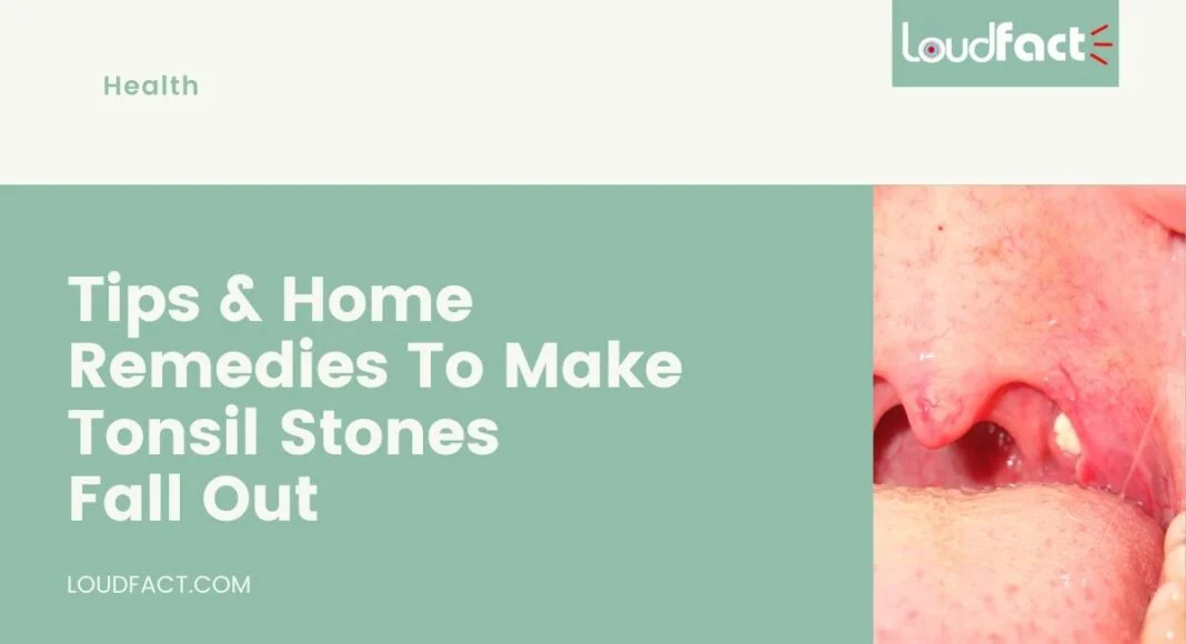 How To Make Tonsil Stones Fall Out