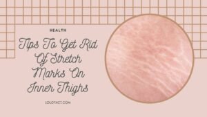 how to get rid of stretch marks on inner thighs how to get rid of stretch marks on inner thighs
