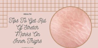 how to get rid of stretch marks on inner thighs