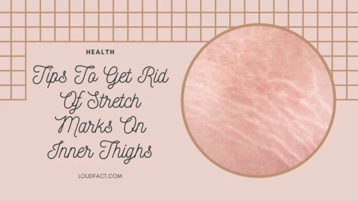 how to get rid of stretch marks on inner thighs
