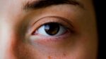 How Do You Know If You Have Cataracts and What to Do About Them
