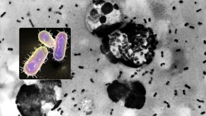 Bubonic Plague Bubonic Plague