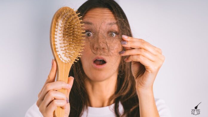 Hair Loss Treatment Hair Loss Treatment