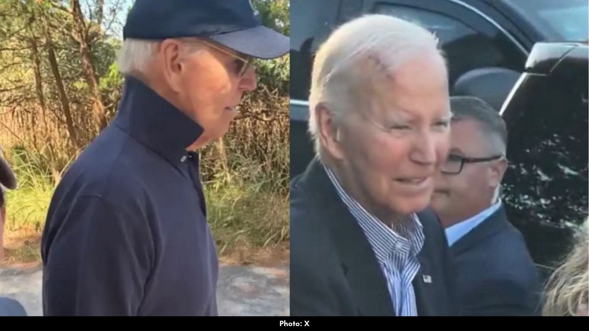 Joe Biden Forehead Scar Video Sparks Health Concerns